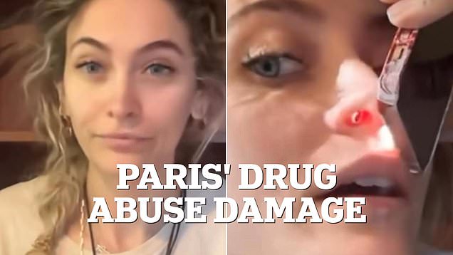Paris Jackson Opens Up About Lifelong Nasal Injury Caused by Drug Abuse